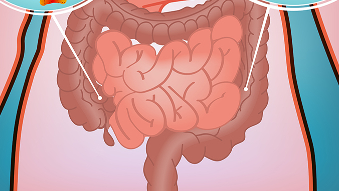 Is rectal carcinoid mostly benign?