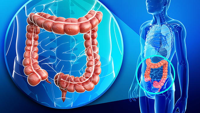 Rectal adenoma postoperative diet