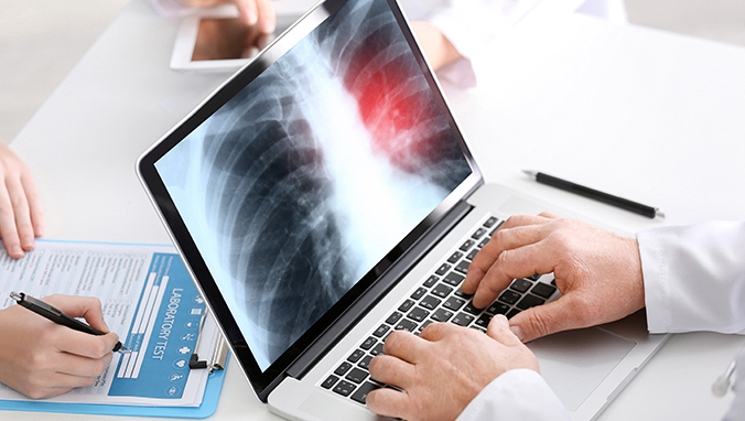 Lung cancer b ultrasound can be checked out