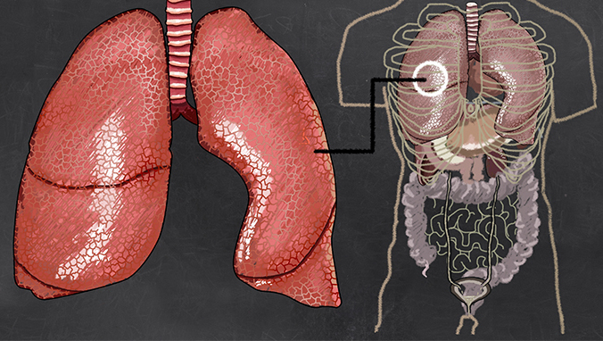 Lung squamous cell carcinoma chemotherapy