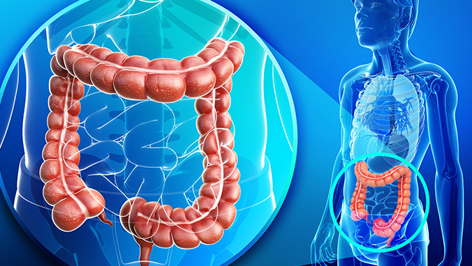 What is external rectal tumor