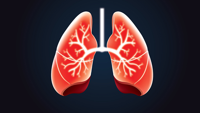 lung cancer(39).jpg