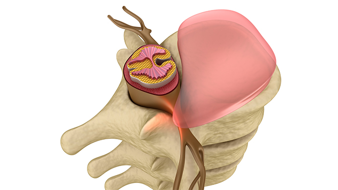 The killer of the perfect quality of life for the elderly-knee osteoarthropathy